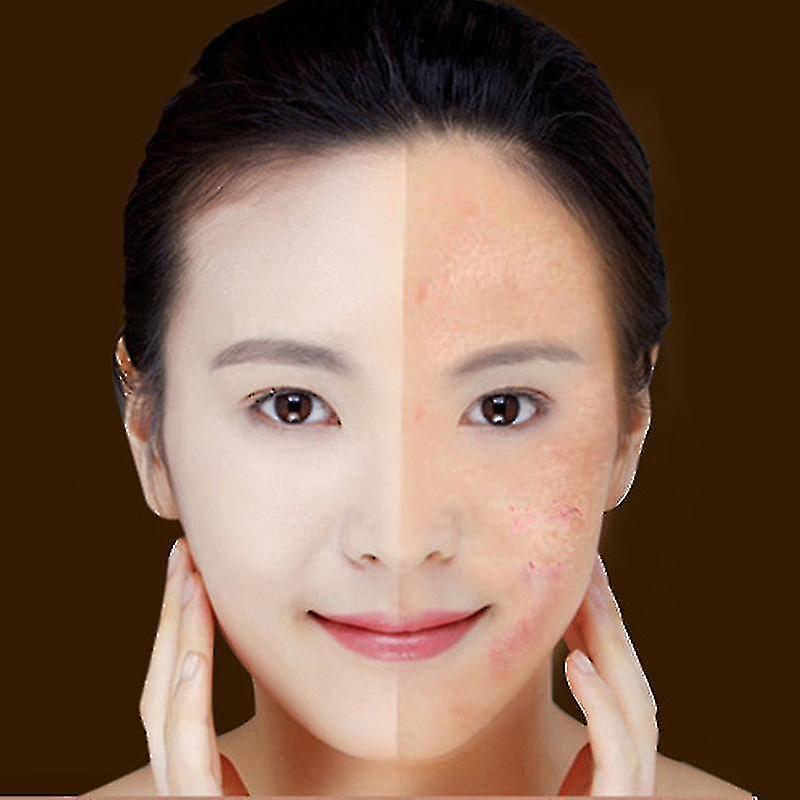 Split-face comparison showing skin before and after using a red and blue light therapy pen.